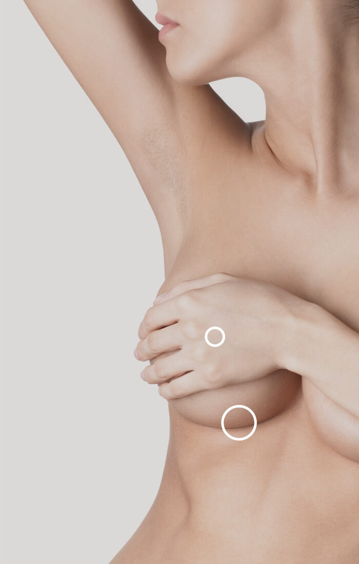 push up apres augmentation mammaire
