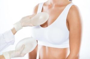taille-implants-mammaire