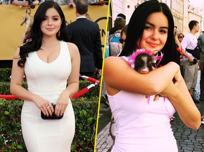 Ariel-Winter-reduction-mammaire