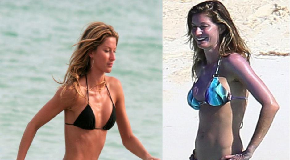 Gisele-Bundchen-augmentation-mammaire