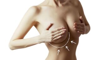 perte de volume des seins