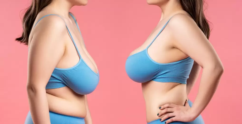 5-techniques-lifting-seins